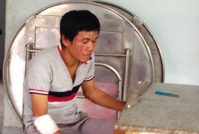 Vietnam cop under preventative treatment after touching HIV-positive robber’s blood