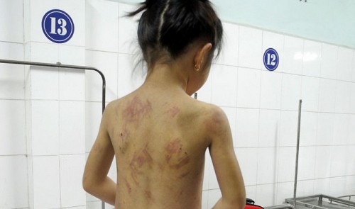 UN vows to purge violence against children in Vietnam