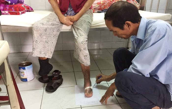 Meet the Vietnamese man who makes ‘shoes without sizes’ for leprosy ...