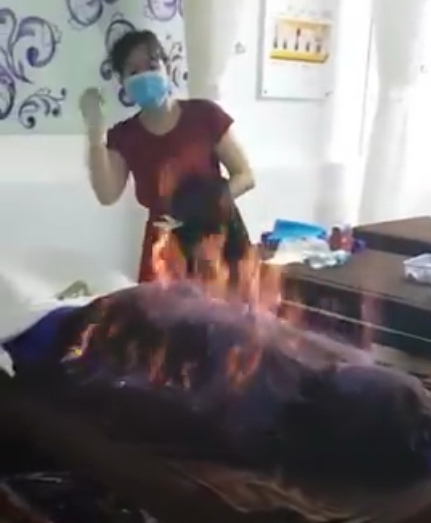 Video of ‘fire therapy’ at Vietnamese beauty parlor spreads fear