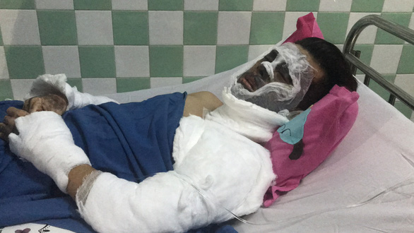Viet Kieu attacked with acid while celebrating Tet in Vietnam