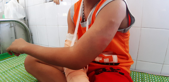L. shows the bruises on his left arm. Photo: Le Trung / Tuoi Tre