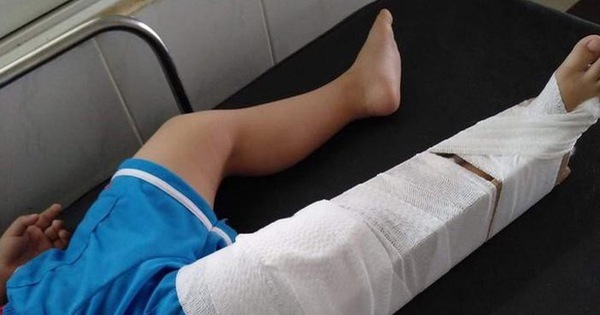 In Vietnam, kindergarten teacher suspended for breaking 3-year-old boy’s leg