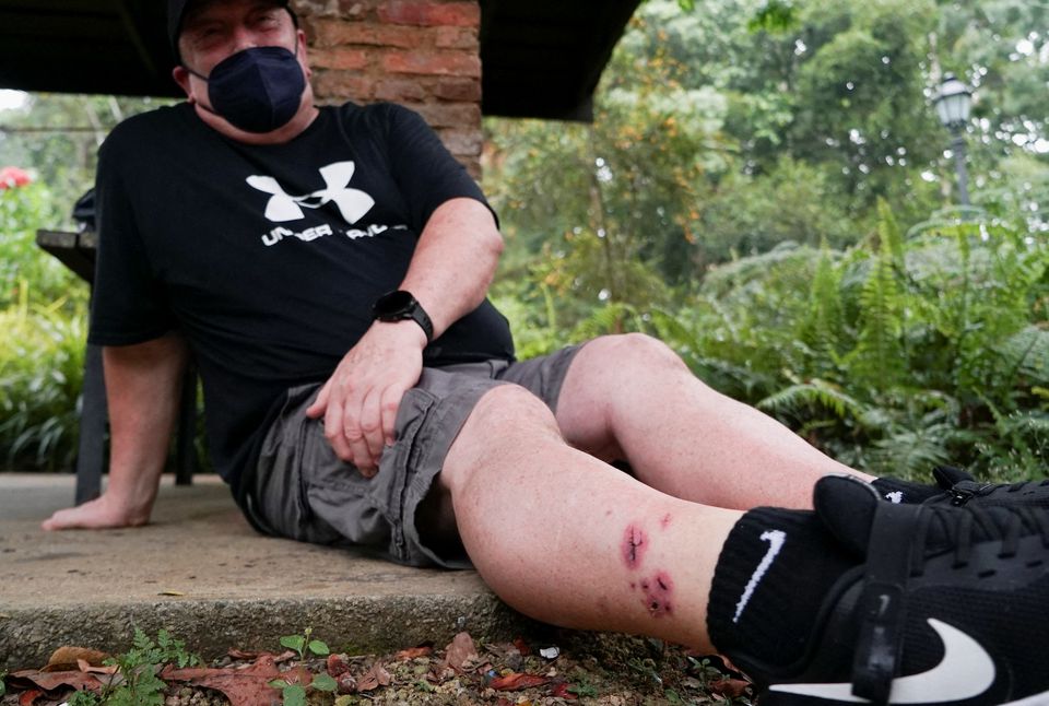 Singapore resident Graham George Spencer shows bite wounds on his right leg he received when he was attacked by Otters in late November, at the Singapore Botanical Gardens in Singapore, December 11, 2021. Photo: Reuters