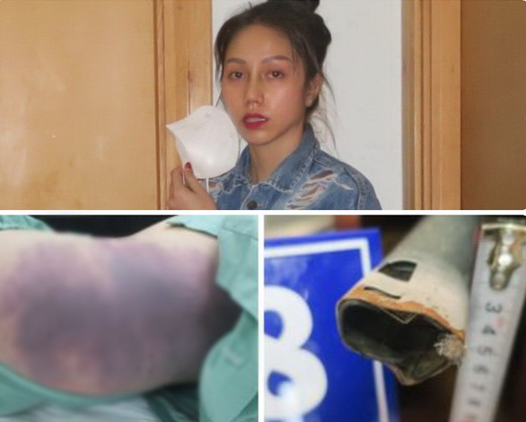 This collage, supplied by Ho Chi Minh City police, shows Nguyen Vo Quynh Trang, wounds caused by her violence on N.T.V.A.’s body and tools that she used to commit the brutalization.