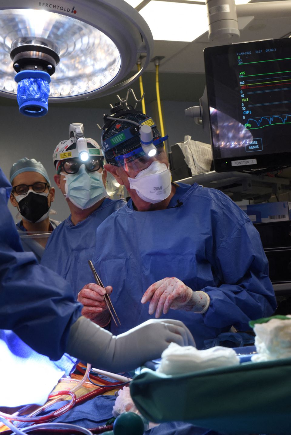 Surgeon Bartley P. Griffith, MD performs a successful transplant of a genetically-modified pig heart on David Bennett, a 57-year-old patient with terminal heart disease, at University of Maryland Medical Center in Baltimore, Maryland, U.S. January 7, 2022. Picture taken January 7, 2022. University of Maryland School of Medicine (UMSOM)/Handout via Reuters