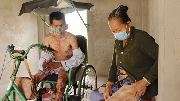In Vietnam, elderly woman donates own skin to save son’s life