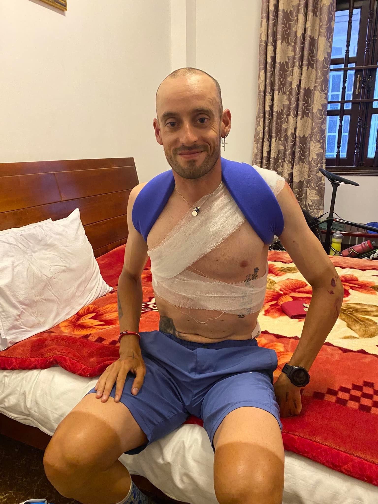 Spaniard Javier Sardá Pérez suffers a broken collarbone and shoulder bone. Photo: Vinh Ngo / Tuoi Tre