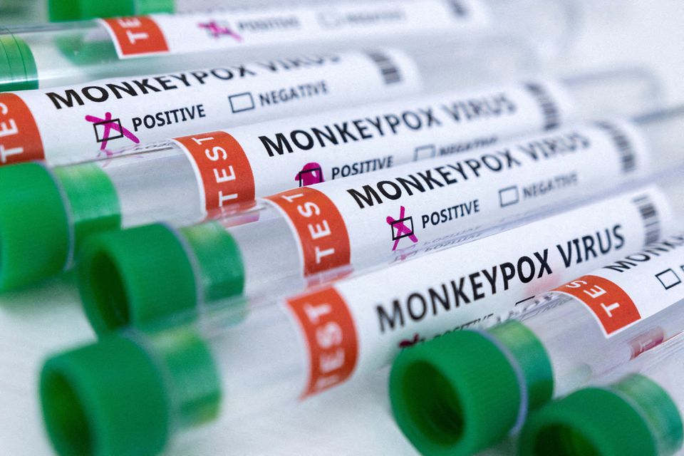 Monkeypox outbreak constitutes global health emergency: WHO