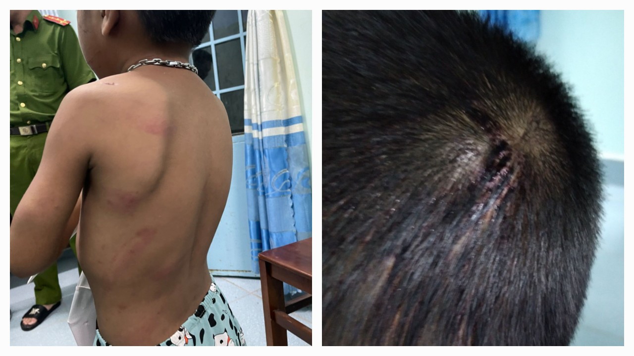 Father in custody for physically abusing son in southern Vietnam