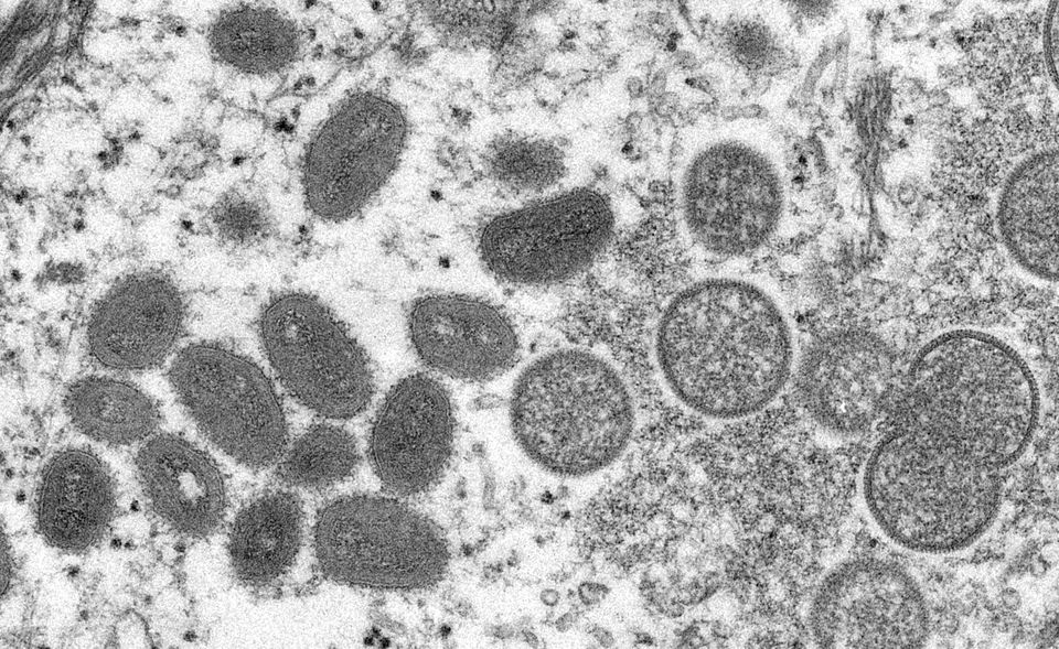 Health ministry warns of monkeypox importation into Vietnam