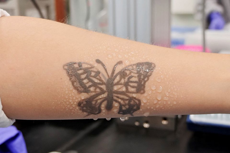 develops nanotech tattoo as health monitoring device | Tuoi Tre News