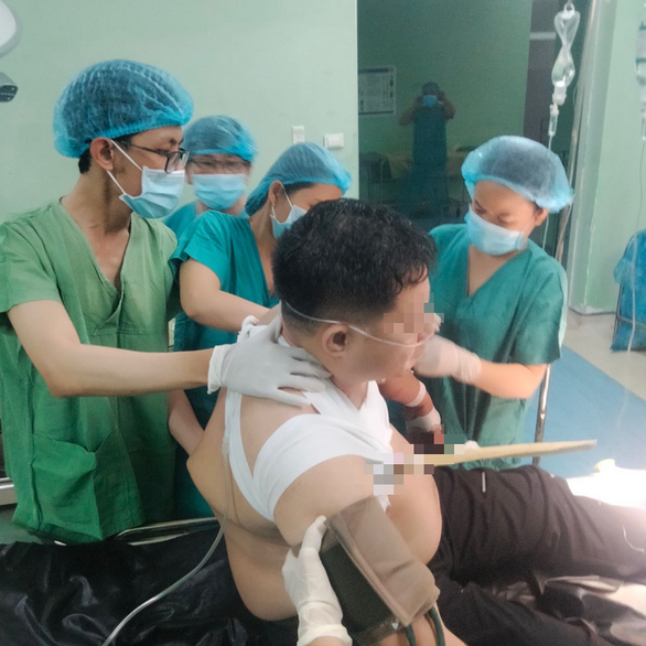 Vietnamese doctors remove wood stick that punctured man’s chest