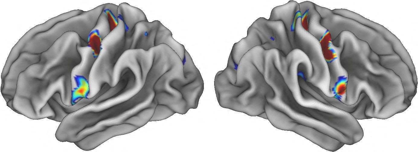 Scientists identify mind-body nexus in human brain